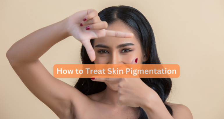 How to Treat Skin Pigmentation in Dark Skin Patches